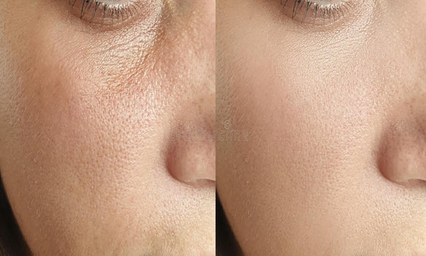 20 Simple Wrinkle Erasers